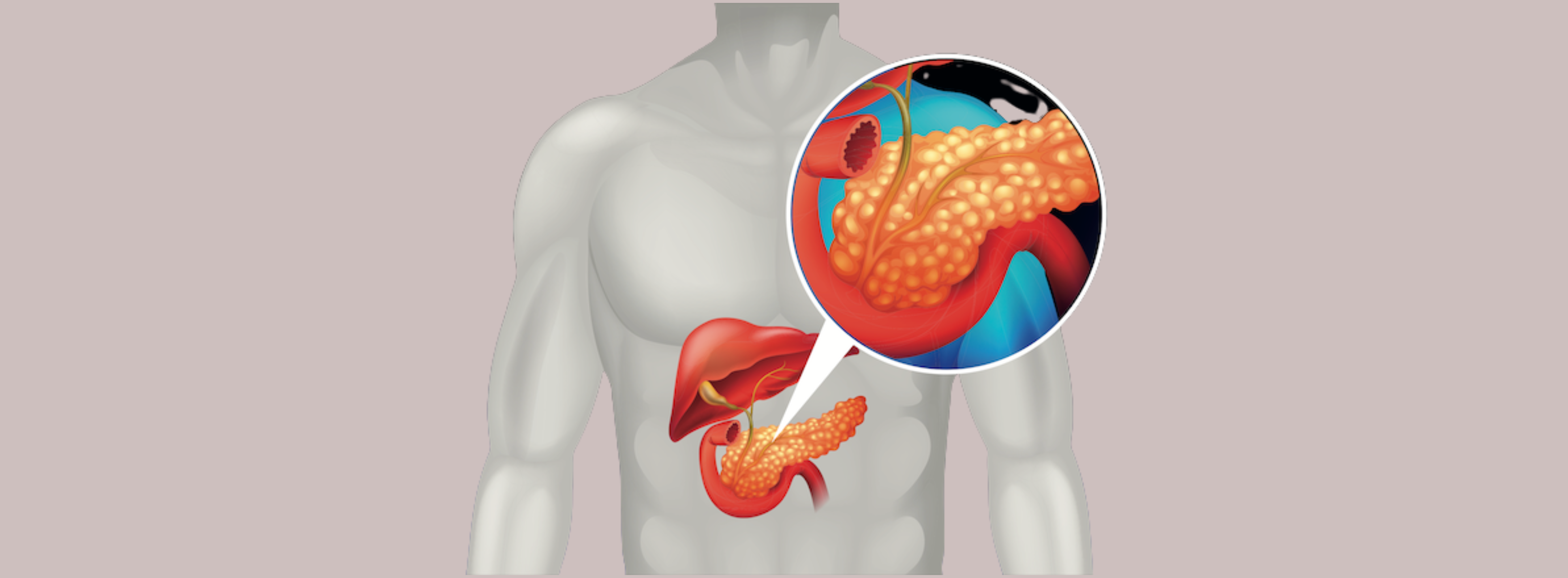 Hepato-Pancreatico-Biliary Cancers