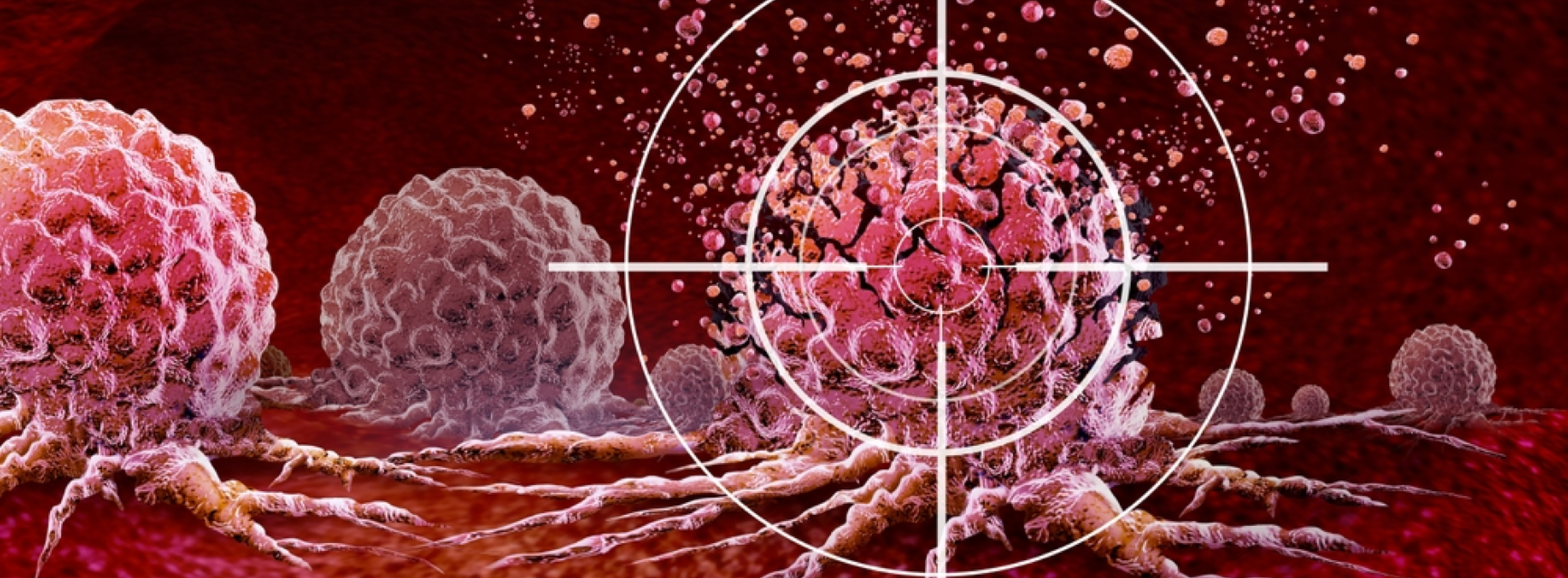 Targeted Therapy